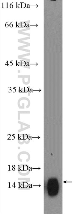 CST2 Rabbit anti-Human, Polyclonal, Proteintech 150 &mu;L; Unconjugated:Antibodies,
