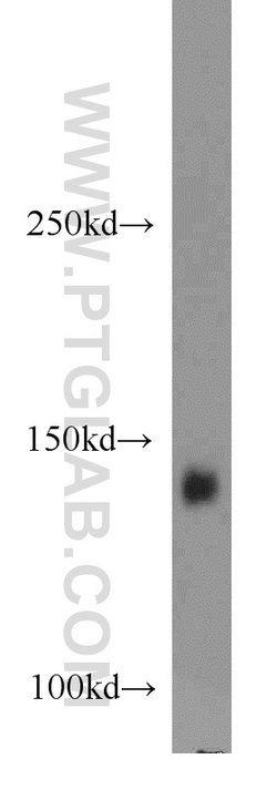 ERBB4 Rabbit anti-Human, Mouse, Rat, Polyclonal, Proteintech:Antibodies:Primary