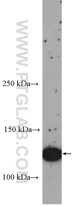 ERBB4 Rabbit anti-Human, Mouse, Rat, Polyclonal, Proteintech:Antibodies:Primary