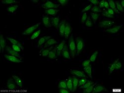 ERBB4 Rabbit anti-Human, Mouse, Rat, Polyclonal, Proteintech:Antibodies:Primary