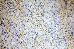 ERBB4 Rabbit anti-Human, Mouse, Rat, Polyclonal, Proteintech:Antibodies:Primary
