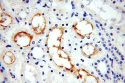 ERBB4 Rabbit anti-Human, Mouse, Rat, Polyclonal, Proteintech:Antibodies:Primary