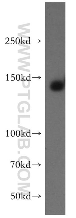 ERBB4 Rabbit anti-Human, Mouse, Rat, Polyclonal, Proteintech:Antibodies:Primary