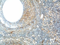 GNRHR Rabbit anti-Human, Mouse, Polyclonal, Proteintech 150 &mu;L; Unconjugated:Antibodies,