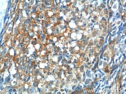 GNRHR Rabbit anti-Human, Mouse, Polyclonal, Proteintech 150 &mu;L; Unconjugated:Antibodies,
