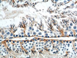 GNRHR Rabbit anti-Human, Mouse, Polyclonal, Proteintech 150 &mu;L; Unconjugated:Antibodies,