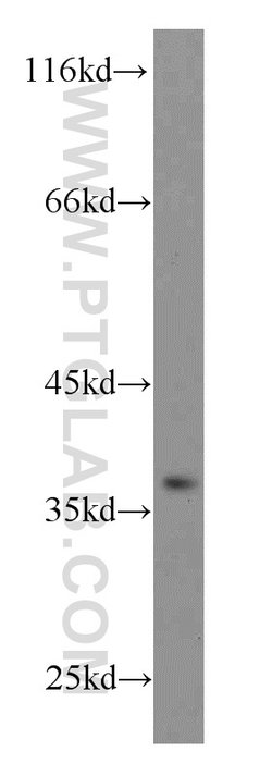 GNRHR Rabbit anti-Human, Mouse, Polyclonal, Proteintech 150 &mu;L; Unconjugated:Antibodies,