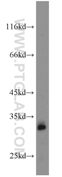 GNRHR Rabbit anti-Human, Mouse, Polyclonal, Proteintech 150 &mu;L; Unconjugated:Antibodies,