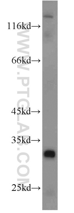 GNRHR Rabbit anti-Human, Mouse, Polyclonal, Proteintech 150 &mu;L; Unconjugated:Antibodies,