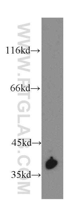 GNRHR Rabbit anti-Human, Mouse, Polyclonal, Proteintech 150 &mu;L; Unconjugated:Antibodies,