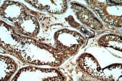 GNRHR Rabbit anti-Human, Mouse, Polyclonal, Proteintech 150 &mu;L; Unconjugated:Antibodies,