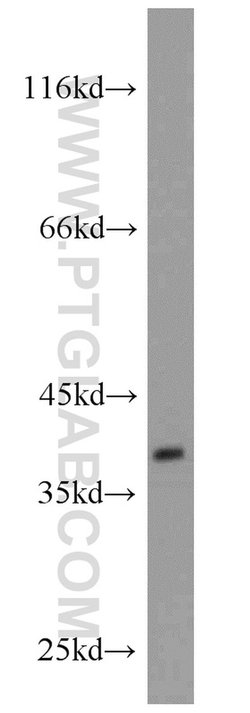 GNRHR Rabbit anti-Human, Mouse, Polyclonal, Proteintech 150 &mu;L; Unconjugated:Antibodies,