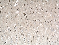 ITPR1 Rabbit anti-Human, Mouse, Rat, Polyclonal, Proteintech 150 &mu;L;