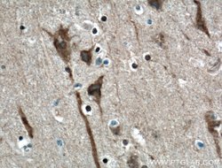 ITPR1 Rabbit anti-Human, Mouse, Rat, Polyclonal, Proteintech 150 &mu;L;