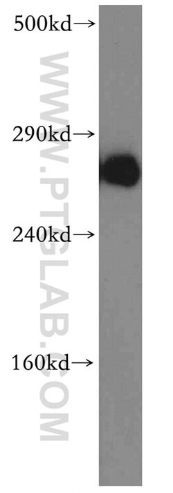 ITPR1 Rabbit anti-Human, Mouse, Rat, Polyclonal, Proteintech 150 &mu;L;