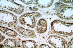 ITPR1 Rabbit anti-Human, Mouse, Rat, Polyclonal, Proteintech 150 &mu;L;