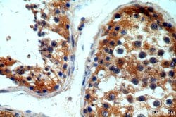 ITPR1 Rabbit anti-Human, Mouse, Rat, Polyclonal, Proteintech 150 &mu;L;