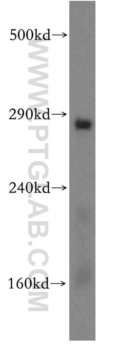 ITPR1 Rabbit anti-Human, Mouse, Rat, Polyclonal, Proteintech 150 &mu;L;