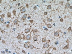 KCNB1 Rabbit anti-Human, Mouse, Polyclonal, Proteintech 150 &mu;L | Buy Online | Proteintech Group Inc | Fisher Scientific