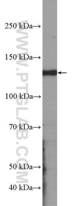 KCNB1 Rabbit anti-Human, Mouse, Polyclonal, Proteintech 150 &mu;L | Buy Online | Proteintech Group Inc | Fisher Scientific