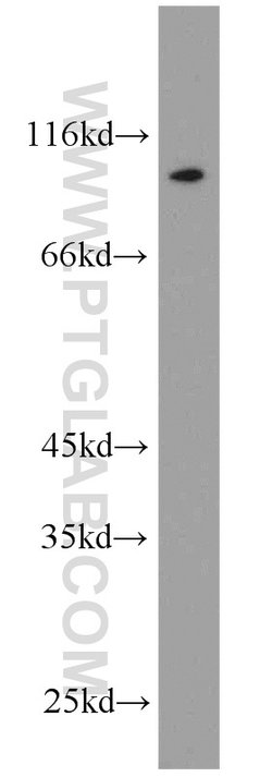LHCGR Rabbit anti-Human, Mouse, Rat, Polyclonal, Proteintech 150 &mu;L;