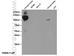 LHCGR Rabbit anti-Human, Mouse, Rat, Polyclonal, Proteintech 150 &mu;L;