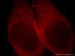 LDHC Rabbit anti-Human, Mouse, Polyclonal, Proteintech:Antibodies:Primary