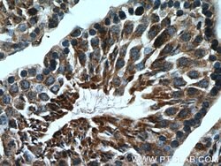 LDHC Rabbit anti-Human, Mouse, Polyclonal, Proteintech:Antibodies:Primary