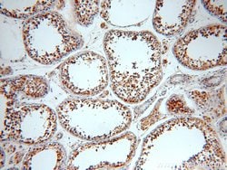 LDHC Rabbit anti-Human, Mouse, Polyclonal, Proteintech:Antibodies:Primary