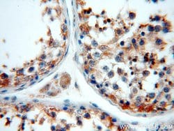 LDHC Rabbit anti-Human, Mouse, Polyclonal, Proteintech:Antibodies:Primary