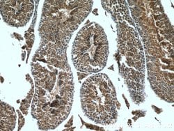LDHC Rabbit anti-Human, Mouse, Polyclonal, Proteintech:Antibodies:Primary