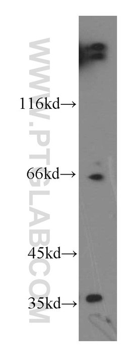 LDHC Rabbit anti-Human, Mouse, Polyclonal, Proteintech:Antibodies:Primary