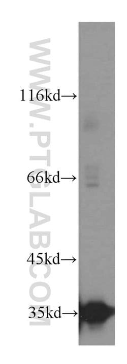 LDHC Rabbit anti-Human, Mouse, Polyclonal, Proteintech:Antibodies:Primary