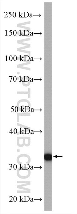LDHC Rabbit anti-Human, Mouse, Polyclonal, Proteintech:Antibodies:Primary