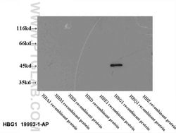 HBG1 Rabbit anti-Human, Polyclonal, Proteintech 150 &mu;L; Unconjugated:Antibodies,