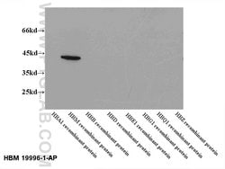 HBM Rabbit anti-Human, Polyclonal, Proteintech