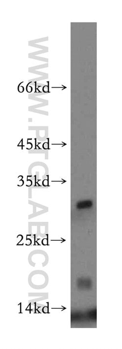 HBM Rabbit anti-Human, Polyclonal, Proteintech:Anticorps:Anticorps primaires