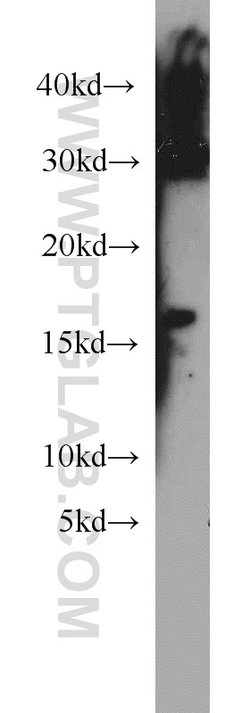 HBM Rabbit anti-Human, Polyclonal, Proteintech:Anticorps:Anticorps primaires