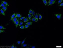 TGF-beta 2 Rabbit anti-Human, Mouse, Polyclonal, Proteintech 150 &mu;L;