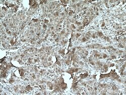 TGF-beta 2 Rabbit anti-Human, Mouse, Polyclonal, Proteintech 150 &mu;L;