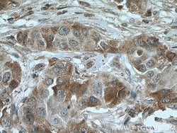 TGF-beta 2 Rabbit anti-Human, Mouse, Polyclonal, Proteintech 150 &mu;L;