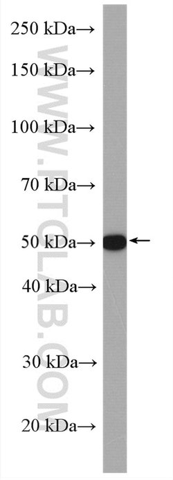 TGF-beta 2 Rabbit anti-Human, Mouse, Polyclonal, Proteintech 150 &mu;L;