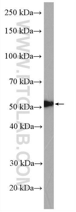 TGF-beta 2 Rabbit anti-Human, Mouse, Polyclonal, Proteintech 150 &mu;L;