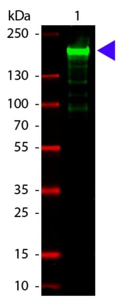 alpha-2-Macroglobulin Polyclonal Antibody, Rockland 25 &mu;L; Unconjugated:Antibodies,