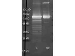 Maltose Phosphorylase Polyclonal Antibody, Rockland:Antibodies:Primary