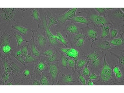 Lactate Dehydrogenase Polyclonal Antibody, Biotin, Rockland 25 &mu;L; Biotin:Antibodies,