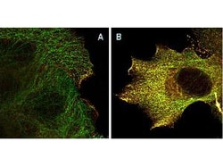 Phospho-AKT (Ser473) Monoclonal Antibody (17F6.B11), Rockland 100 &mu;g;