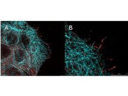 Phospho-AKT (Ser473) Monoclonal Antibody (17F6.B11), Rockland 100 &mu;g;