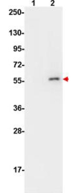 Phospho-AKT (Ser473) Monoclonal Antibody (17F6.B11), Rockland 100 &mu;g;