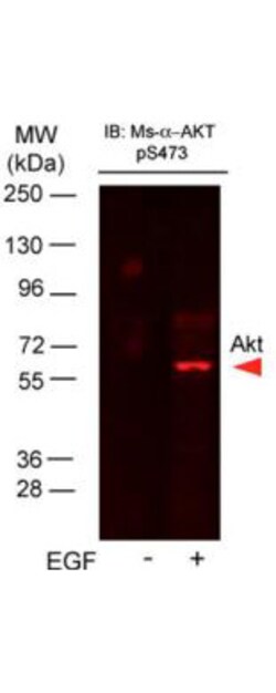 Phospho-AKT (Ser473) Monoclonal Antibody (17F6.B11), Rockland 100 &mu;g;